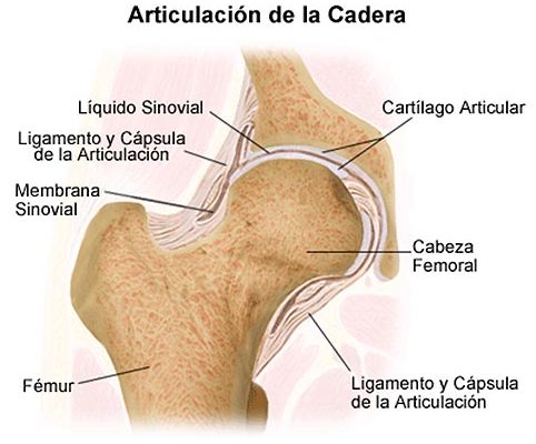 artritis-cadera-acupuntura