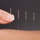 acupuntura mejora