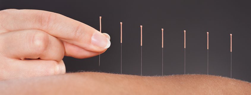acupuntura mejora